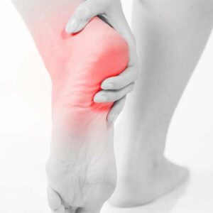 Plantar Fasciitis in triathlon running Plantar Fasciitis in triathlon running