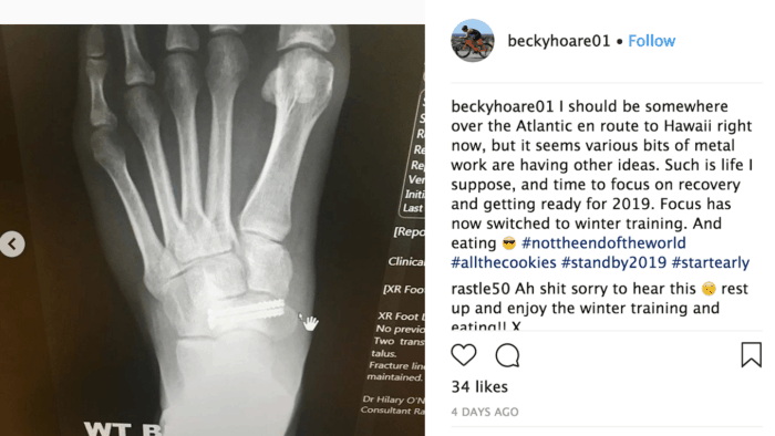 #GBKona 2018 - Becky Hoare injury IRONMAN World Championship 2018